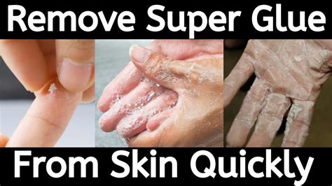 how to get super glue off hands with salt|How to Get Superglue Off the Skin: Methods and Steps.